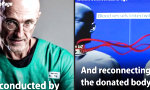 Lustiges Video : Erste Kopftransplantation steht an